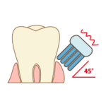 歯と歯茎の間の磨き方